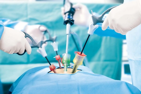 A surgeon performing surgery on a patient at the Best Laparoscopic Hospital in Kota.