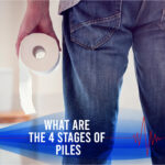 What Are The 4 Stages Of Piles?  